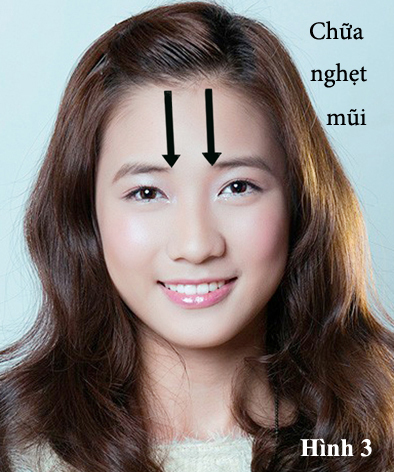 phuong-phap-massage-bam-huyet-va-dieu-tri-ngat-mui-4